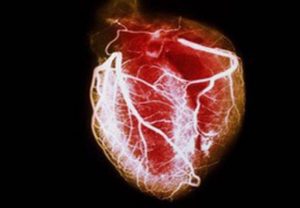 بهبود آسیب های ناشی از حملات قلبی با تزریق هیدروژل